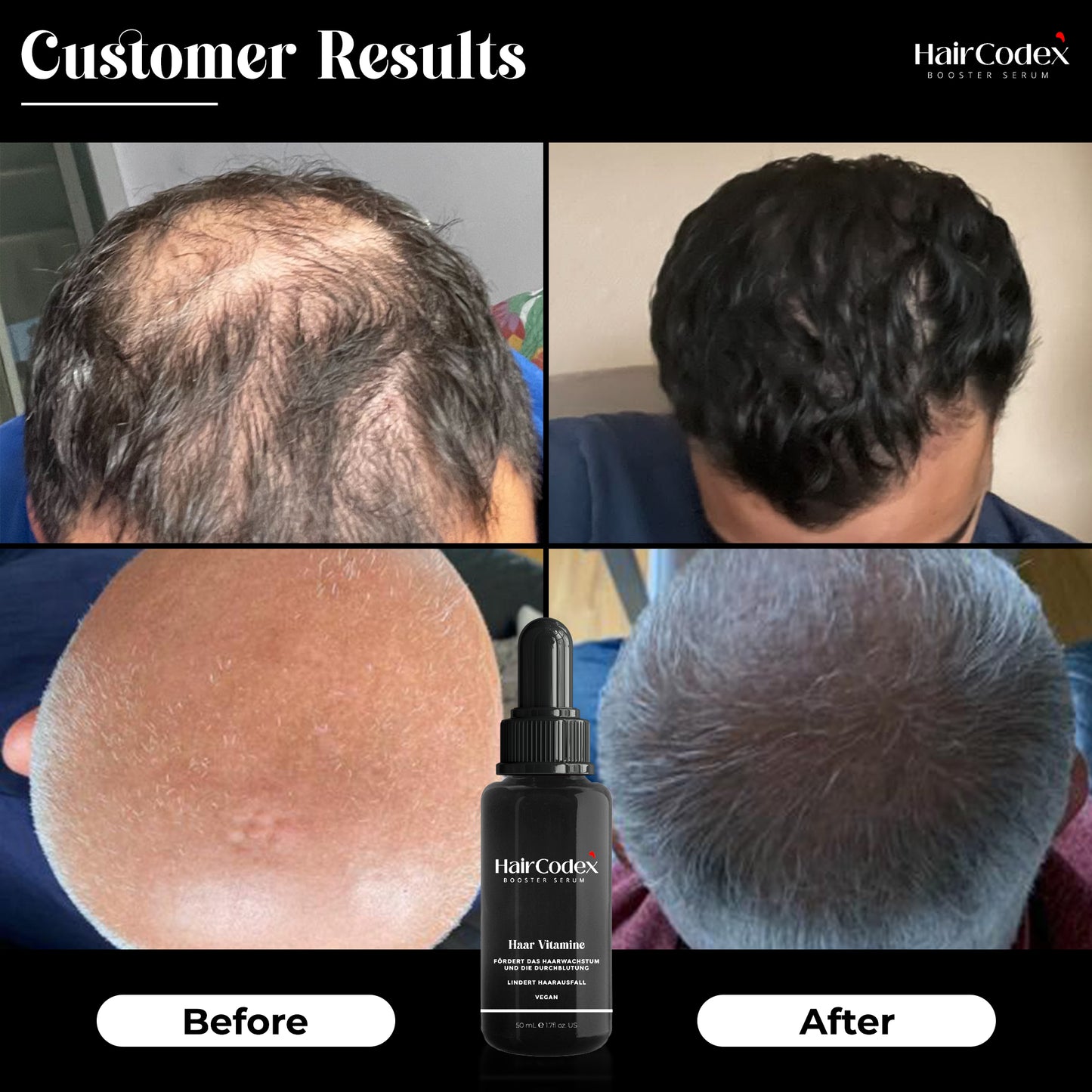 HairCodex® Booster Serum